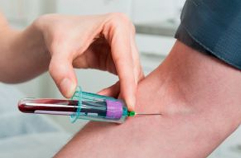 Cardiac Test Packages